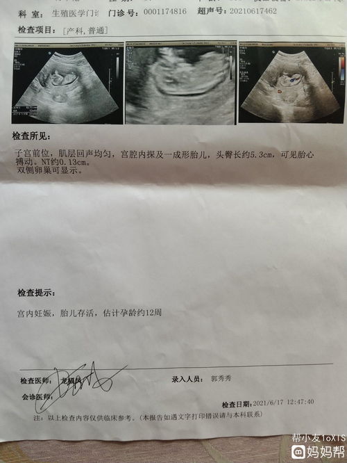 做nt需要多少钱!上海女友怀孕12周检查nt多少钱？
